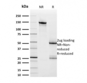 SDS-PAGE analysis of purified, BSA-free HER2 antibody (clone ERBB2/2453) as confirmation of integrity and purity.