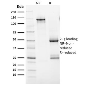 SDS-PAGE analysis of purified, BSA-free HER2 antibody (clone ERBB2/2452) as confirmation of integrity and purity.