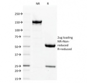 SDS-PAGE analysis of purified, BSA-free Filaggrin antibody (clone FLG/1563) as confirmation of integrity and purity.