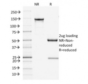 SDS-PAGE analysis of purified, BSA-free Filaggrin antibody (clone FLG/1945) as confirmation of integrity and purity.