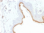 IHC testing of FFPE human skin with Filaggrin antibody (clone FLG/1945). Required HIER: boil tissue sections in 10mM citrate buffer, pH 6, for 10-20 min.