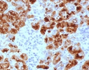 IHC testing of FFPE human pancreas with GP2 antibody (clone PSGMG2-1). HIER: boil tissue sections in pH 9 10mM Tris with 1mM EDTA for 10-20 min and allow to cool before testing.
