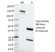 SDS-PAGE analysis of purified, BSA-free MSH6 antibody (clone MSH6/2111) as confirmation of integrity and purity.