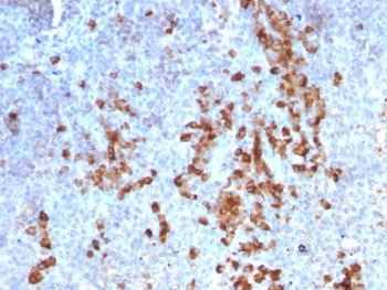 IHC testing of FFPE human tonsil tissue with recombinant anti-Kappa light chain antibody (clone rKLC709). Required HIER: boil tissue sections in pH 9 10mM Tris with 1mM EDTA for 10-20 min followed by cooling at RT for 20 min.~