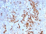 IHC testing of FFPE human tonsil tissue with recombinant anti-Kappa light chain antibody (clone rKLC709). Required HIER: boil tissue sections in pH 9 10mM Tris with 1mM EDTA for 10-20 min followed by cooling at RT for 20 min.