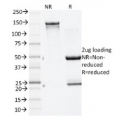 SDS-PAGE analysis of purified, BSA-free GAD65 antibody (clone GAD2/1960) as confirmation of integrity and purity.