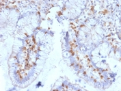 IHC testing of FFPE human small intestine with CD103 antibody (clone ITGAE/2063). HIER: boil tissue sections in pH6, 10mM citrate buffer, for 10-20 min followed by cooling at RT for 20 min.