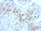 IHC testing of FFPE human colon with CD103 antibody (clone ITGAE/2063). HIER: boil tissue sections in pH6, 10mM citrate buffer, for 10-20 min followed by cooling at RT for 20 min.