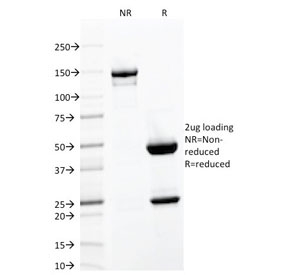 SDS-PAGE analysis of purified, BSA-free CD103 antibody (clone ITGAE/2063) as confirmation of integrity and purity.