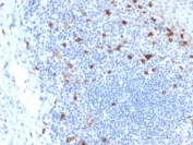 IHC testing of FFPE human tonsil with CD103 antibody (clone ITGAE/2063). HIER: boil tissue sections in pH6, 10mM citrate buffer, for 10-20 min followed by cooling at RT for 20 min.