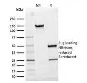 SDS-PAGE analysis of purified, BSA-free CD25 antibody (clone IL2RA/2395) as confirmation of integrity and purity.
