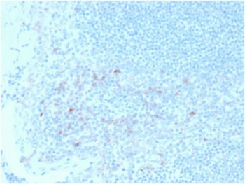 IHC testing of FFPE human tonsil tissue with CD25 antibody (clone IL2RA/2395). HIER: boil tissue sections in pH6, 10mM citrate buffer, for 10-20 min followed by cooling at RT for 20 min.~