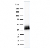 Western blot testing of human A431 cell lysate with TROP2 antibody (clone TACSTD2/2151). Predicted molecular weight ~36 kDa.