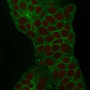 Immunofluorescent staining of human MCF7 cells with TROP2 antibody (green, clone TACSTD2/2152) and Reddot nuclear stain (red).