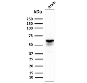 Western blot testing of human brain lysate with GAD67 antibody. Expected molecular weight ~67 kDa.~