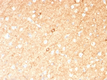 IHC testing of FFPE human brain with GAD67 antibody (clone GAD1/2391). Required HIER: boil tissue sections in 10mM citrate buffer, pH 6,
