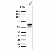 Western blot testing of human brain lysate with GAD67 antibody. Expected molecular weight ~67 kDa.