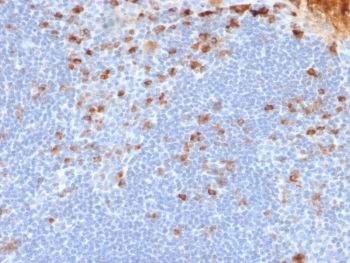 IHC testing of FFPE human tonsil tissue with recombinant Kappa Light Chain antibody (clone rL1C1). Required HIER: boil tissue sections in pH 9 10mM Tris with 1mM EDTA for 10-20 min followed by cooling at RT for 20 min.~