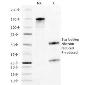 SDS-PAGE analysis of purified, BSA-free TROP2 antibody (clone TACSTD2/2153) as confirmation of integrity and purity.