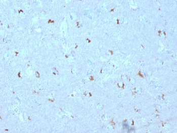 IHC testing of FFPE human brain with GAD67 antibody (clone GAD1/2563). Required HIER: boil tissue sections in 10mM citrate buffer, pH 6, for 10-20 min.~
