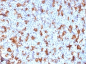 IHC testing of FFPE human tonsil with CD11c antibody (clone ITGAX/2507). Required HIER: boil tissue sections in pH6, 10mM citrate buffer, for 10-20 min followed by cooling at RT for 20 min.