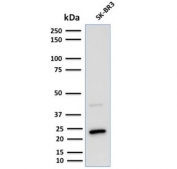 Western blot testing of human SK-BR-3 cell lysate (mammary gland tumor cell line) with Mammaglobin antibody (clone MGB/2000). Expected molecular weight: 10-21 kDa depending on level of glycosylation.