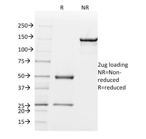 SDS-PAGE analysis of purified, BSA-free Mammaglobin antibody (clone MGB/2000) as confirmation of integrity and purity.