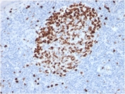 IHC testing of FFPE human tonsil stained with Ki67 antibody (MKI67/2462). Required HIER: boiling tissue sections in pH 9 10mM Tris with 1mM EDTA for 10-20 min followed by cooling at RT for 20 min.