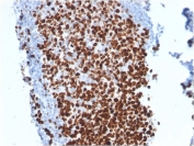 IHC testing of FFPE human tonsil stained with Ki67 antibody (MKI67/2462). Required HIER: boiling tissue sections in pH 9 10mM Tris with 1mM EDTA for 10-20 min followed by cooling at RT for 20 min.
