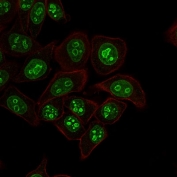 Immunofluorescent staining of human HeLa cells with Ki-67 antibody (green, clone MKI67/2462) and Phalloidin (red, membrane stain).