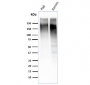 Western blot testing of human Raji and Ramos cell lysate with Ki67 antibody. Expected molecular weight ~350 kDa.
