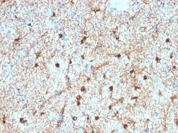 IHC testing of FFPE human cerebellum stained with Gli