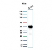 Western blot testing of human brain tissue with Glial Fibrillary Acidic Protein antibody. Predicted molecular weight ~50 kDa.