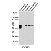 GFAP Antibody Brain Tissue WB. Western blot analysis of human brain, mouse brain, rat brain, guinea pig brain, and hamster brain tissue lysates using Glial fibrillary acidic protein Antibody clone GFAP/2076. A strong band is detected at approximately 50 kDa in human brain lysate, with additional bands of similar molecular weight observed in rat, guinea pig, and hamster brain samples, consistent with the predicted molecular weight of GFAP, a major astrocytic intermediate filament protein involved in maintenance of neural cytoskeletal organization and central nervous system integrity. Subtle lower molecular weight bands forming a faint stacked pattern beneath the primary human brain signal likely represent GFAP isoforms and/or partial proteolytic processing products commonly observed in neural tissue extracts.