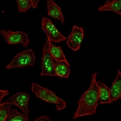Immunofluorescent staining of human HeLa cells with Ki-67 antibody (green, clone MKI67/2465) and Phalloidin (red, membrane stain).