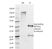SDS-PAGE analysis of purified, BSA-free MTAP antibody (clone MTAP/1813) as confirmation of integrity and purity.