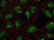 Immunofluorescent staining of human HeLa cells with Ki67 antibody (green, clone PMKI67-1) and Phalloidin (red, membrane stain).