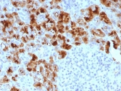 IHC testing of FFPE human pancreas with GP2 antibody (clone GP2/1803). HIER: boil tissue sections in pH 9 10mM Tris with 1mM EDTA for 10-20 min and allow to cool before testing.