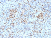 IHC staining of FFPE human spleen with PU.1 antibody (clone PU1/2146). HIER: boil tissue sections in pH 9 10mM Tris with 1mM EDTA for 10-20 min followed by cooling at RT for 20 min.