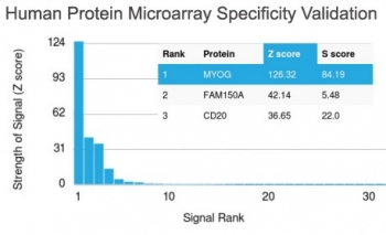 Analysis of HuProt(TM) microarray containi