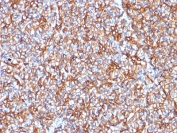 IHC testing of FFPE human pancreas with Spectrin beta III antibody (clone SPTBN2/1778). Required HIER: boil tissue sections in 10mM citrate buffer, pH 6, for 10-20 min followed by cooling at RT for 20 min.