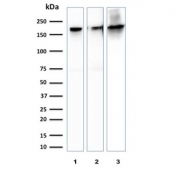 Western blot testing of human 1) HeLa, 2) PC-3 and 3) brain lysate with Spectrin beta III antibody. Predicted molecular weight ~246 kDa.