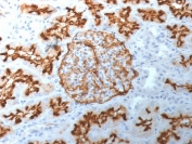 IHC staining of FFPE human kidney with CD10 antibody (clone MME/1892). Required HEIR: boil tissue sections in 10mM Tris with 1mM EDTA, pH 9, for 10-20 min and allow to cool before testing.