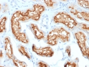 IHC staining of FFPE human kidney with CD10 antibody (clone MME/1870). Required HEIR: boil tissue sections in 10mM Tris with 1mM EDTA, pH 9, for 10-20 min and allow to cool before testing.
