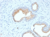 IHC staining of FFPE human prostate with CD10 antibody (clone MME/1870). Required HEIR: boil tissue sections in 10mM Tris with 1mM EDTA, pH 9, for 10-20 min and allow to cool before testing.
