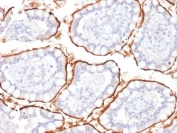 IHC staining of FFPE human colon with CD10 antibody (clone MME/1870). Required HEIR: boil tissue sections in 10mM Tris with 1mM EDTA, pH 9, for 10-20 min and allow to cool before testing.