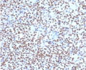 IHC staining of FFPE human lymph node with PU.1 antibody (clone TFPU1-1). HIER: boil tissue sections in pH 9 10mM Tris with 1mM EDTA for 10-20 min followed by cooling at RT for 20 min.