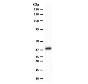 Western blot testing of human THP-1 cell lysate with PU.1 antibody (clone TFPU1-1). Predicted molecular weight ~31 kDa but routinely observed at ~40 kDa.~