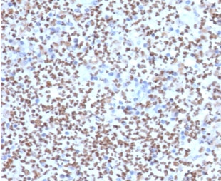 IHC staining of FFPE human lymph node with PU.1 antibody (clone TFPU1-1). HIER: bo
