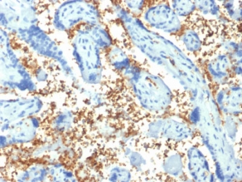 IHC staining of FFPE human placenta with SPTA1 antibody (clone SPTA1/1810). Required HIER: boil tissue sections in pH6, 10mM citrate buffer, for 10-20 min followed by cooling at RT for 20 min.~